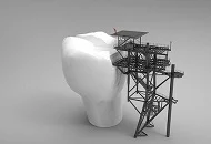 Cat costa extractia unei masele de minte?