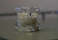 Servicii de protetica dentara