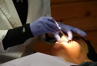 Cum se calculeaza pretul pentru o punte dentara