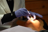 Indepartarea unei lucrari dentare deteriorate