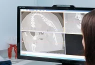 Servicii de tomografie dentara si preturile acestora