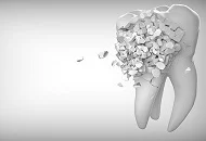 Cand este necesar un pivot dentar