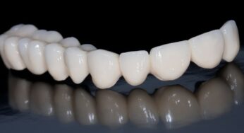 Avantajele montarii unei coroane dentare din zirconiu