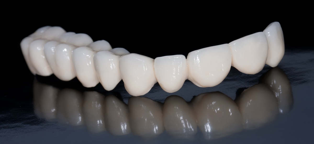 Avantajele montarii unei coroane dentare din zirconiu