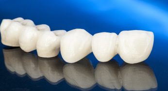 Avantajele unei coroane dentare