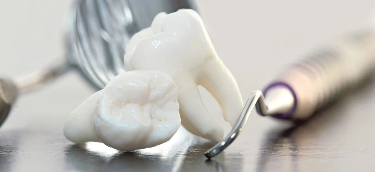 Extractii dentare in Bucuresti