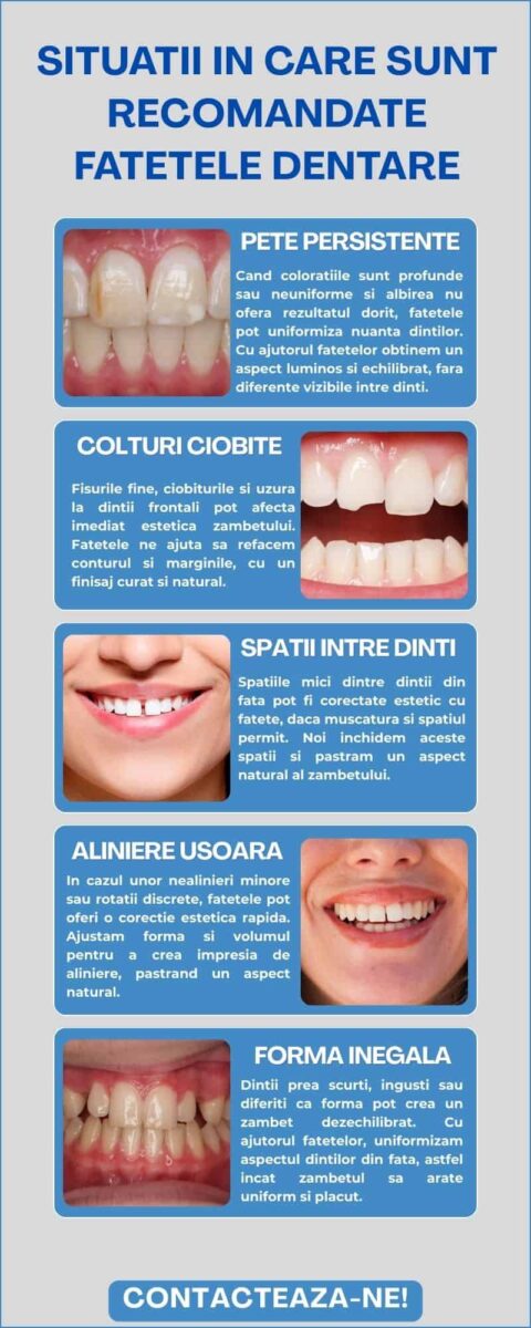 Situatii in care sunt recomandate fatetele dentare