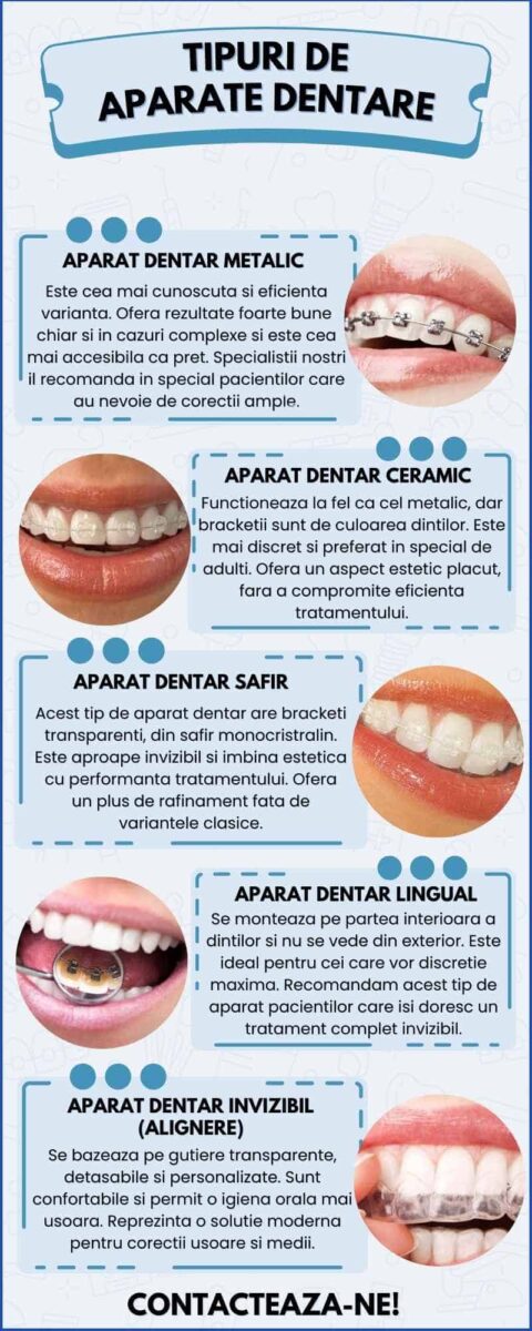Tipuri de aparate dentare